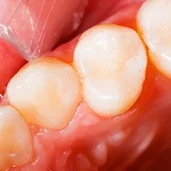стоматологическая клиника доктор профи плюс изображение 6 на проекте brateevo.su